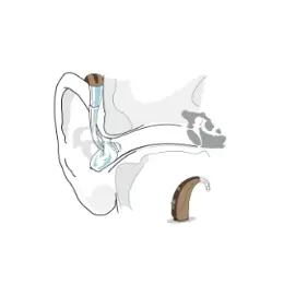 Contour d'oreille